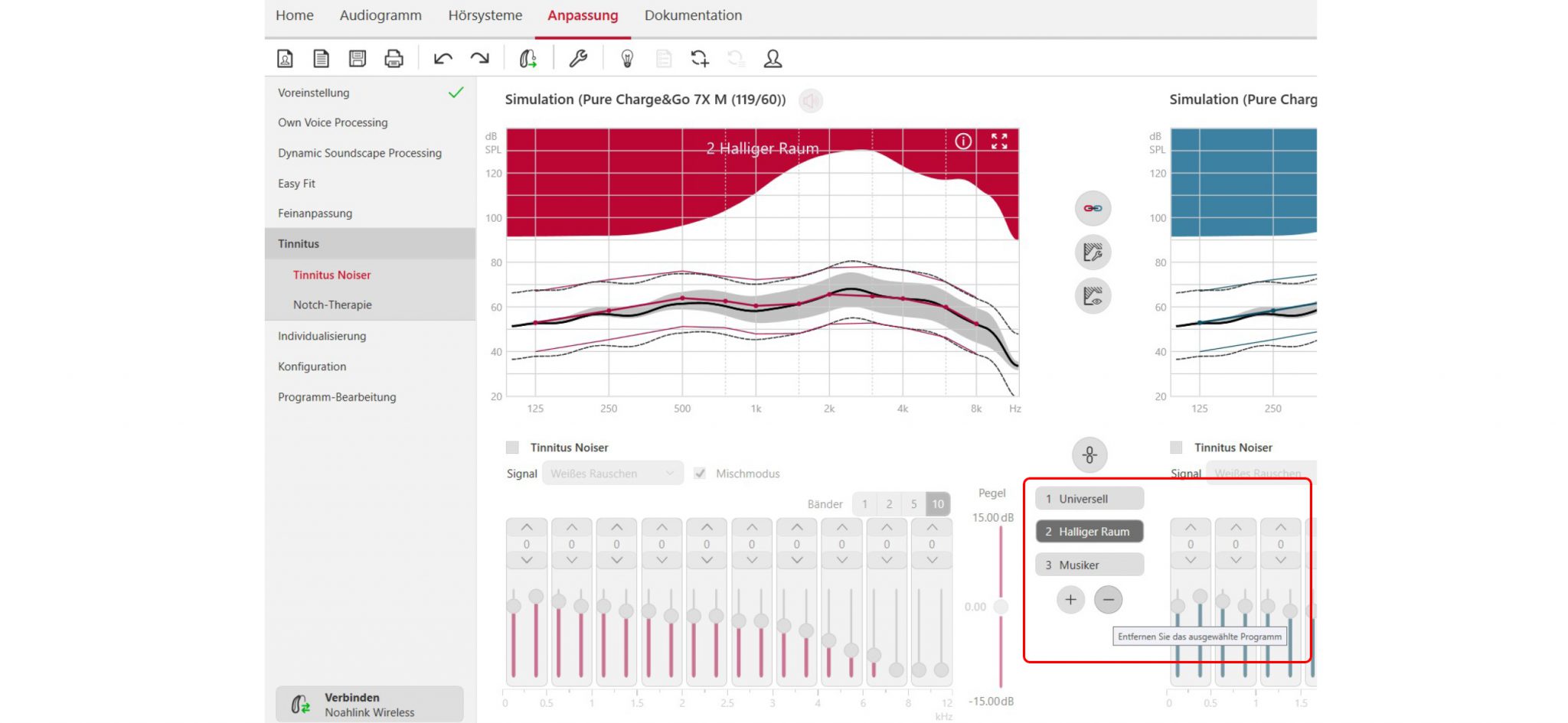 signia connexx 8.5.x software download